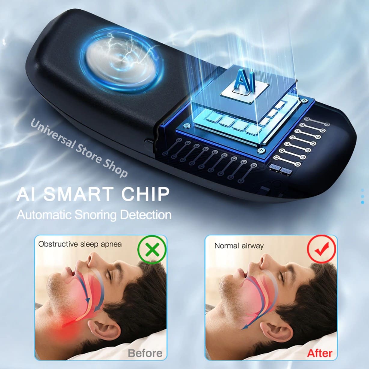 Dispositivo Electrónico Profesional Para Dormir Antironquido